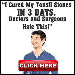 Tonsil Stones cure banner